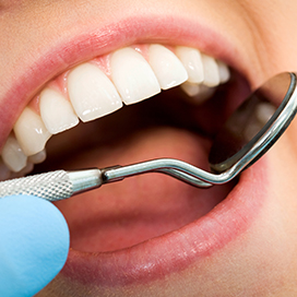 What Causes Dental Plaque and Tartar?