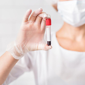 5 Things you can find out from a blood test