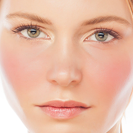 How to solve sudden face redness before the wedding?