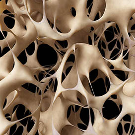 Factors that Contribute to Osteoporosis
