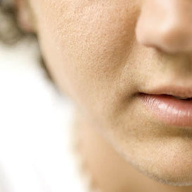 Your Guide to Blackheads